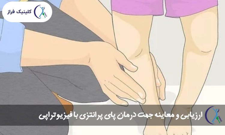 ارزیابی و معاینه جهت درمان پای پرانتزی