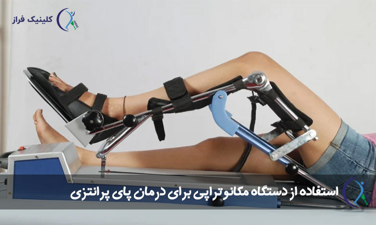 استفاده از دستگاه مکانوتراپی برای درمان پای پرانتزی 