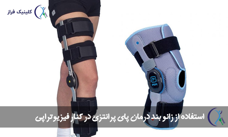 استفاده از زانو بند درمان پای پرانتزی در کنار فیزیوتراپی