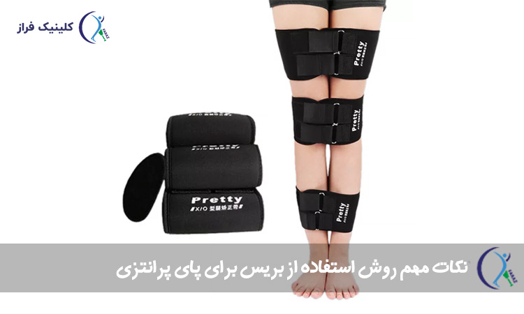 نکات مهم روش استفاده از بریس برای پای پرانتزی
