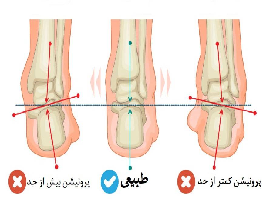 عکس چرخش مچ پا
