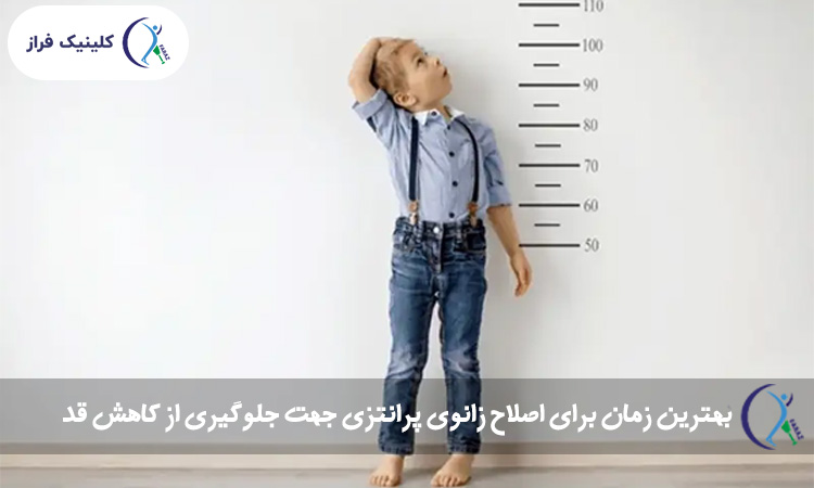 بهترین زمان برای اصلاح زانوی پرانتزی جهت جلوگیری از کاهش قد