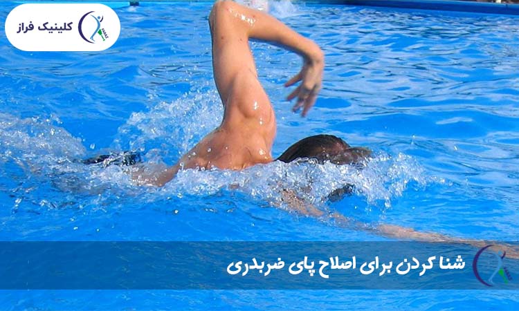 شنا کردن برای اصلاح پای ضربدری