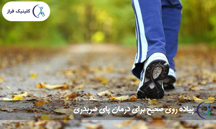 پیاده روی صحیح برای درمان پای ضربدری