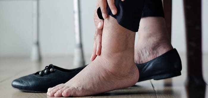 پای دیابتی