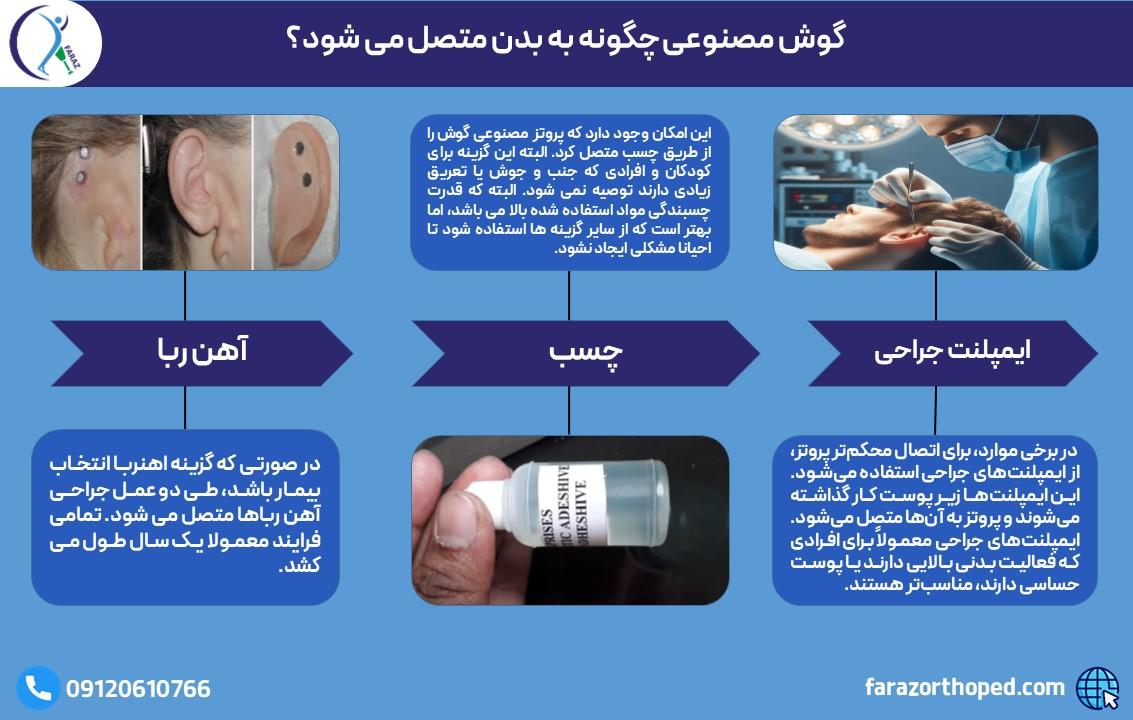 گوش مصنوعی چگونه به بدن متصل می شود؟