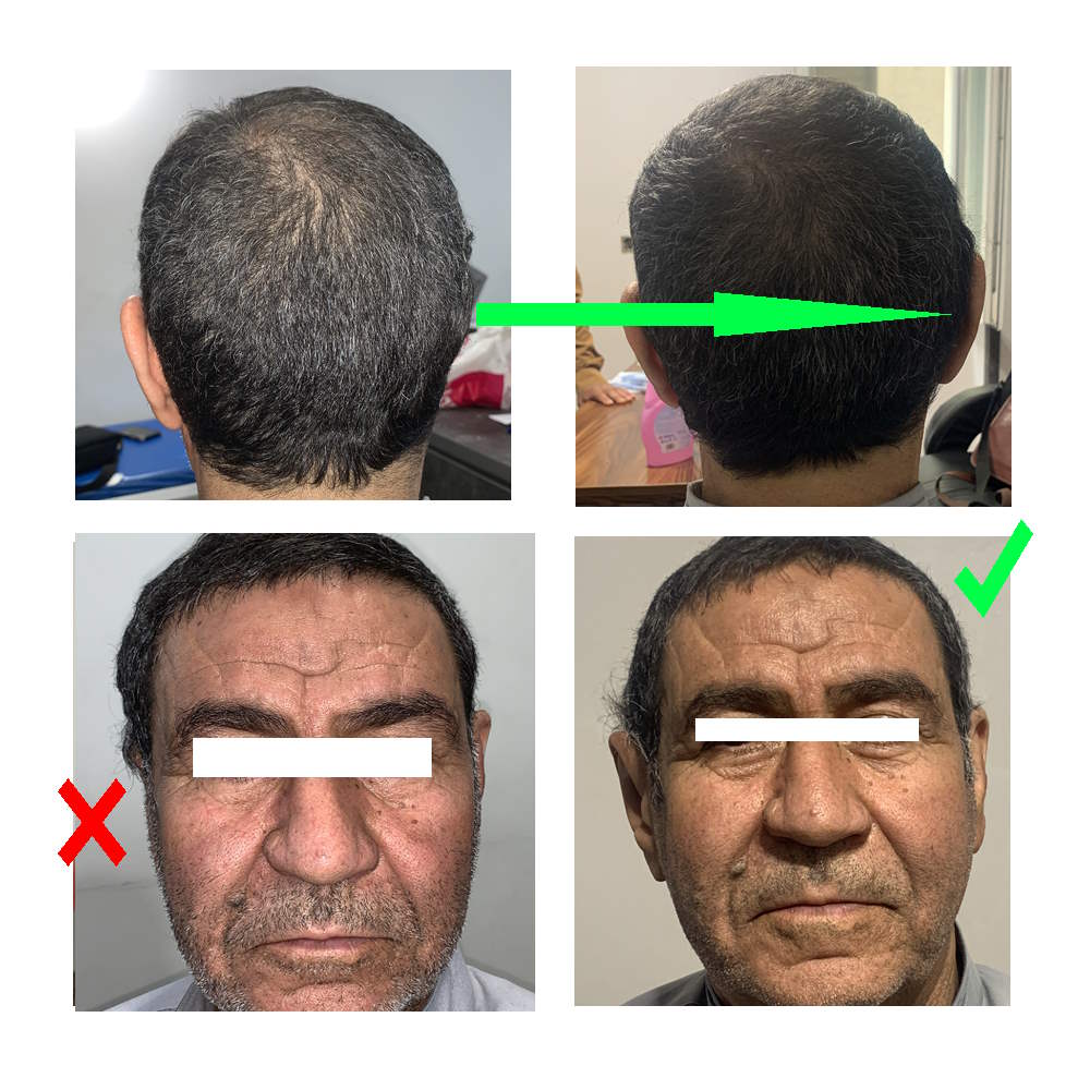 پروتز گوش ساخت کلینیک فراز