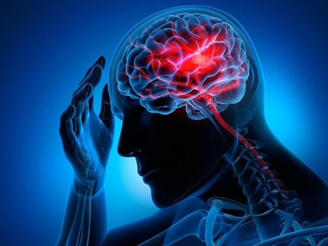 درمان فلج سکته مغزی و مدت زمان بهبود - کلینیک ارتوپد فنی فراز