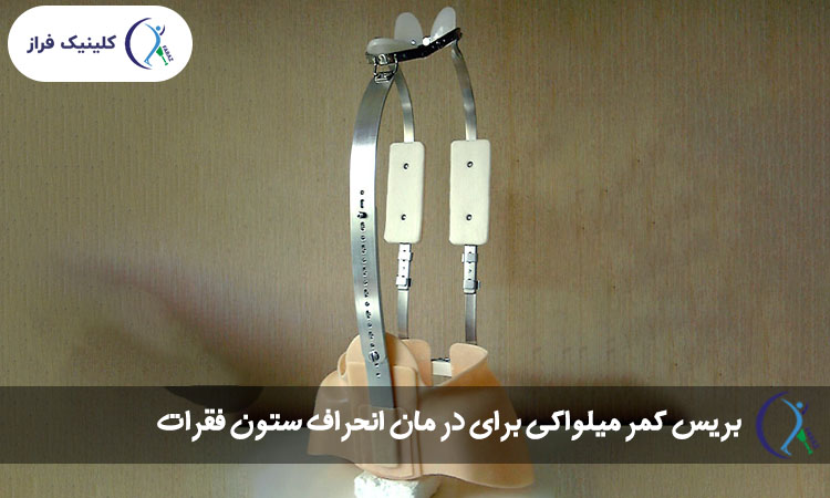 بریس کمر میلواکی