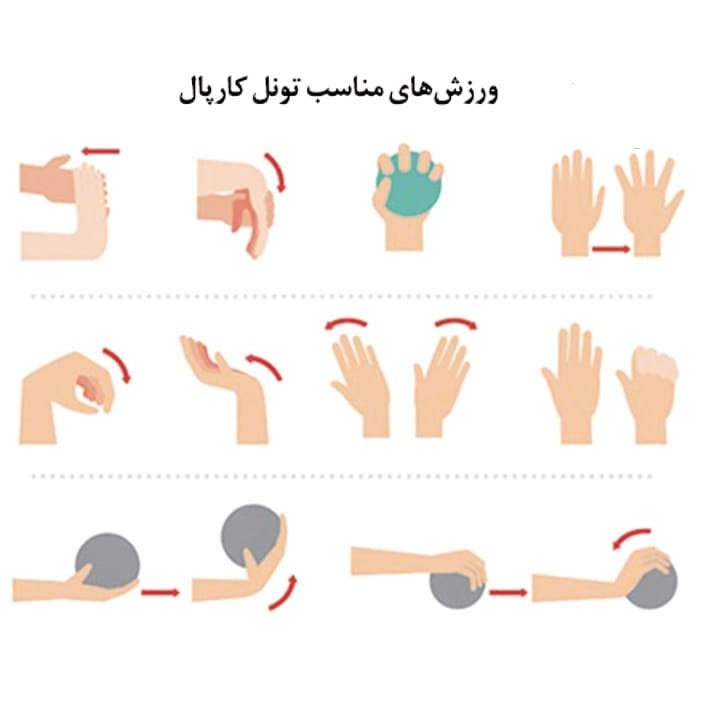 ورزش تونل کارپال