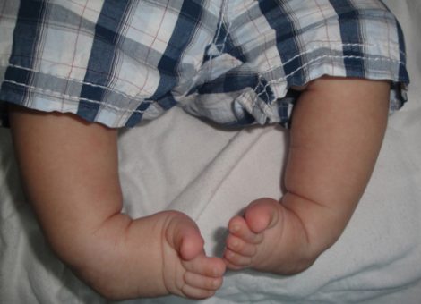 عکس کلاب فوت در کودک