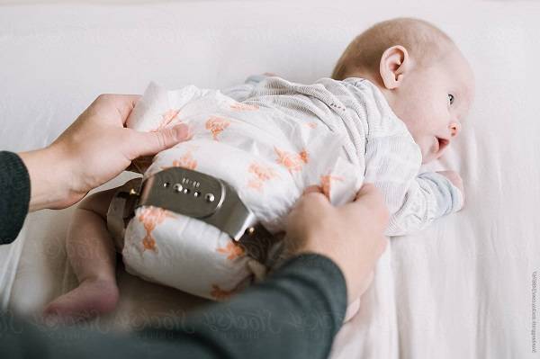 بریس پاولیک هارنس برای در رفتگی لگن