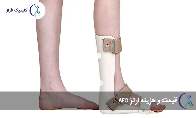 قیمت و هزینه ارتز AFO