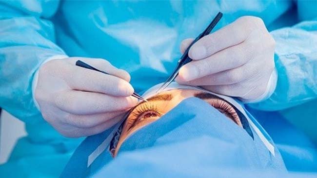 مراقبت بعد از عمل تخلیه چشم