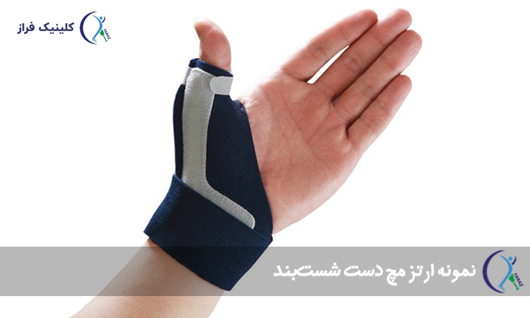 ارتز مچ دست شست‌بند