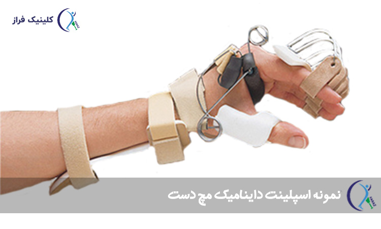 اسپلینت داینامیک مچ دست