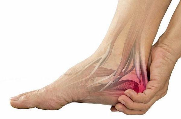 کفش مخصوص تاندون آَشیل