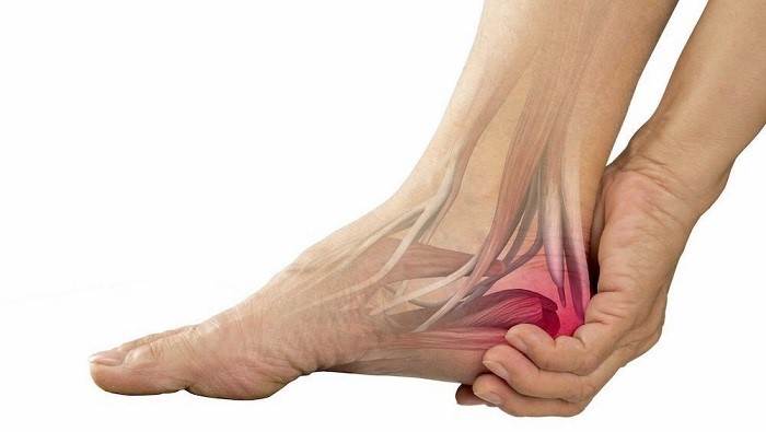 کفش مخصوص تاندون آَشیل