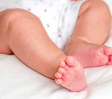 روش های پیشگیری از زانوی پرانتزی در نوزادان