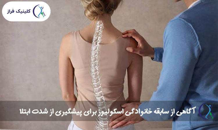 آگاهی از سابقه خانوادگی اسکولیوز