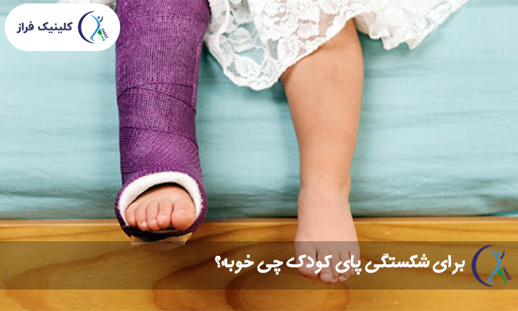 برای شکستگی پای کودک چی خوبه