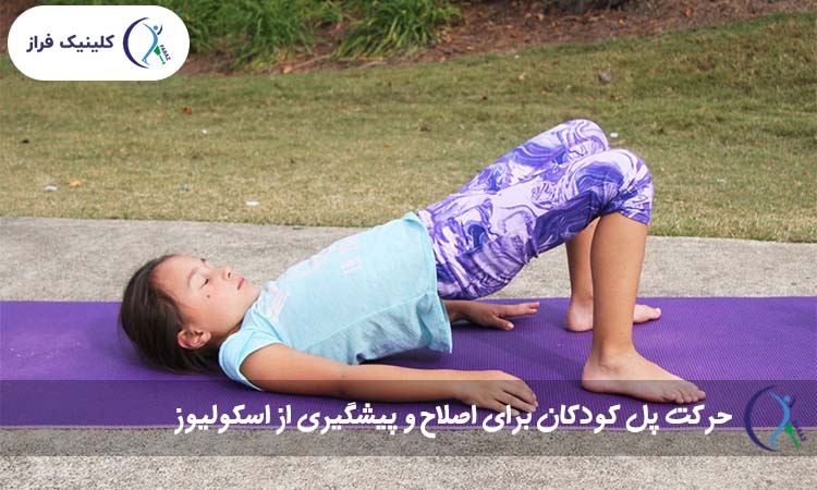 حرکت پل کودکان برای اصلاح و پیشگیری از اسکولیوز