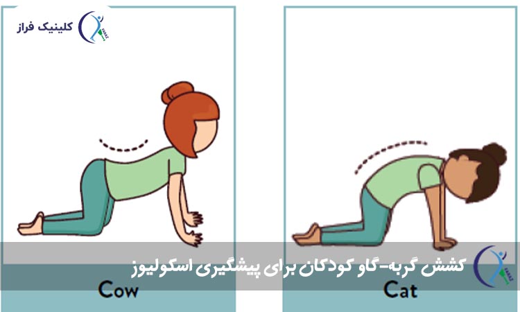 کشش گربه-گاو کودکان برای پیشگیری اسکولیوز