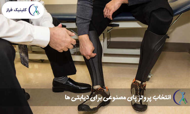 انتخاب پروتز پای مصنوعی برای دیابتی ها