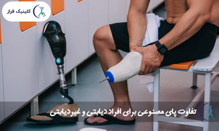 تفاوت پای مصنوعی برای افراد دیابتی و غیردیابتی