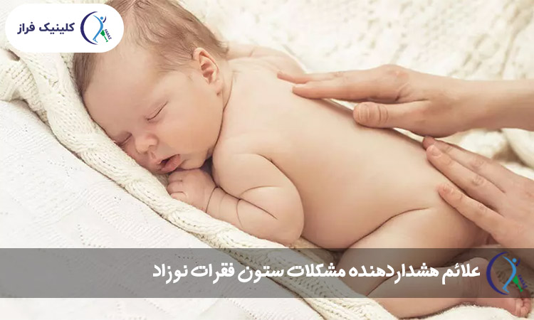 علائم هشداردهنده مشکلات ستون فقرات نوزاد