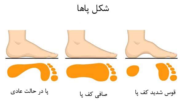 شکل کف پا