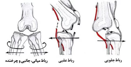 عکس زانوی دارای انحراف