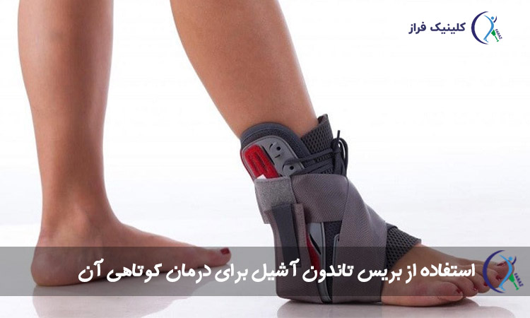 بریس تاندون آشیل