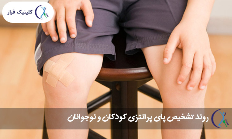 روند تشخیص پای پرانتزی کودکان و نوجوانان
