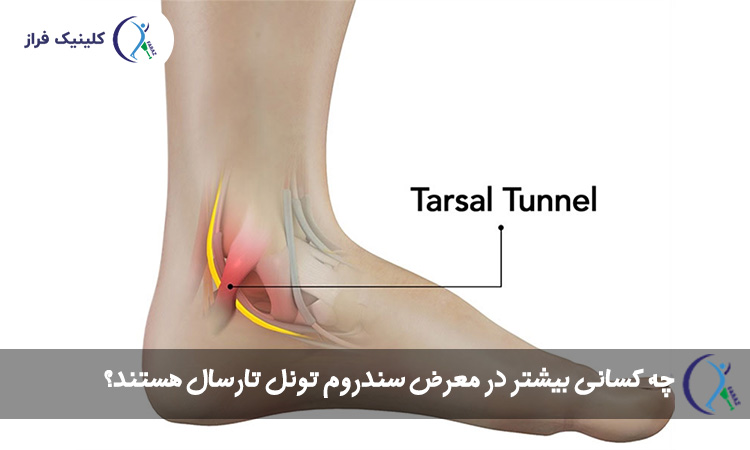 چه کسانی بیشتر در معرض سندروم تونل تارسال هستند؟