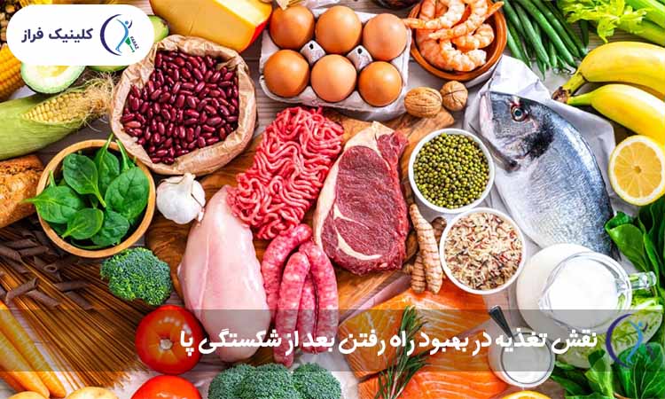 نقش تغذیه در بهبود راه رفتن بعد از شکستگی پا