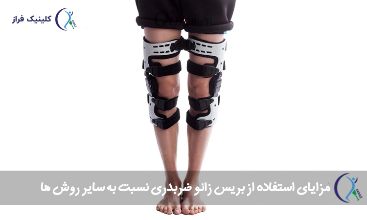 مزایای استفاده از بریس زانو ضربدری نسبت به سایر روش ها