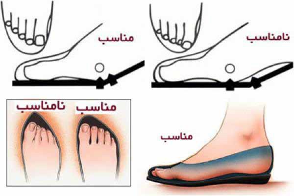 ویژگی های کفش مناسب