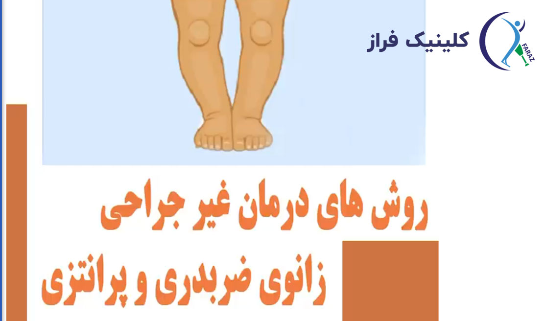 روش های غیر جراحی درمان زانو پرانتزی