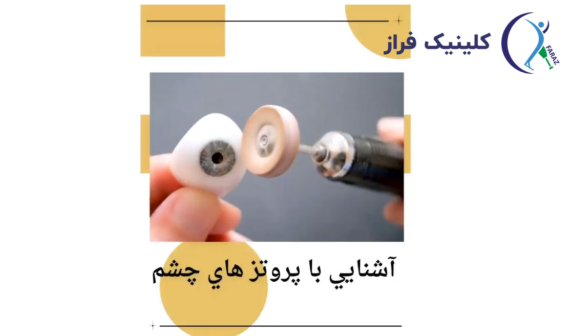 انواع پروتز چشم