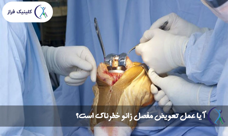 آیا عمل تعویض مفصل زانو خطرناک است؟