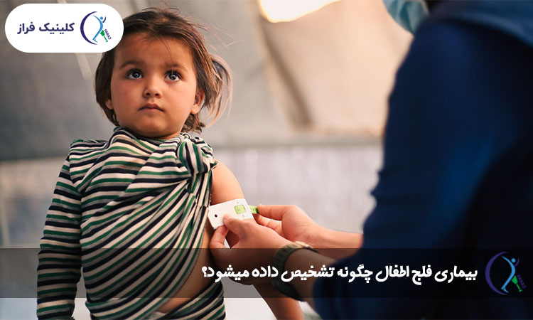 بیماری فلج اطفال چگونه تشخیص داده میشود؟