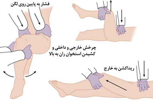 درمان چرخش لگن در کودکان