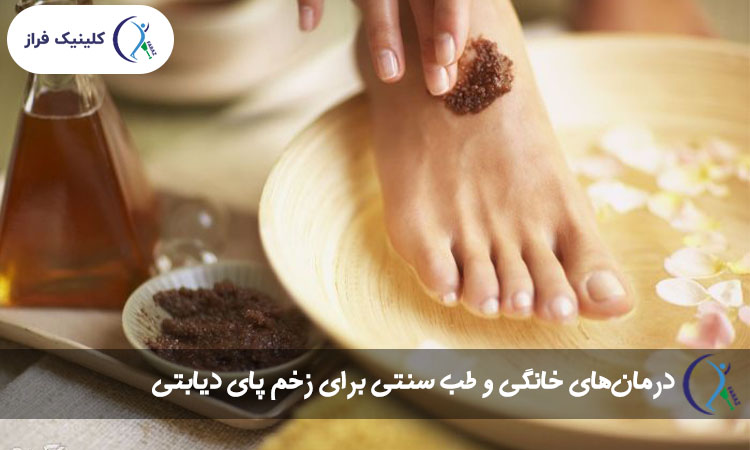 درمان‌های خانگی و طب سنتی برای زخم پای دیابتی