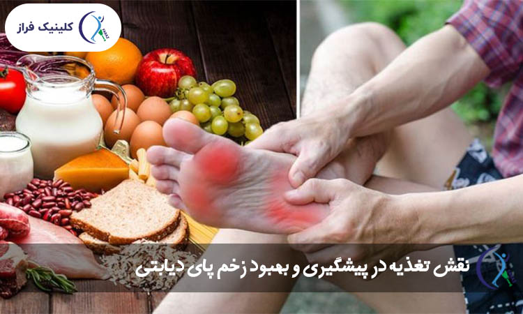 نقش تغذیه در پیشگیری و بهبود زخم پای دیابتی