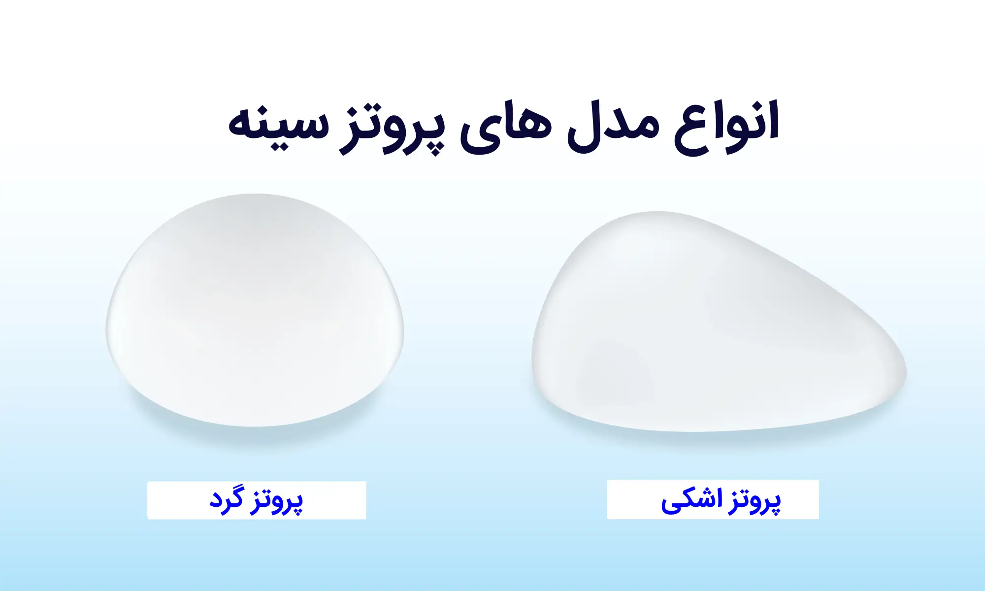 انواع پروتز سینه