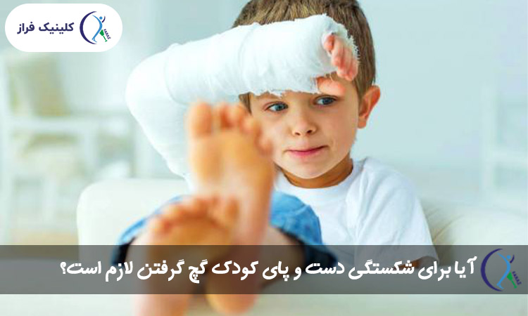 آیا برای شکستگی دست و پای کودک گچ گرفتن لازم است؟