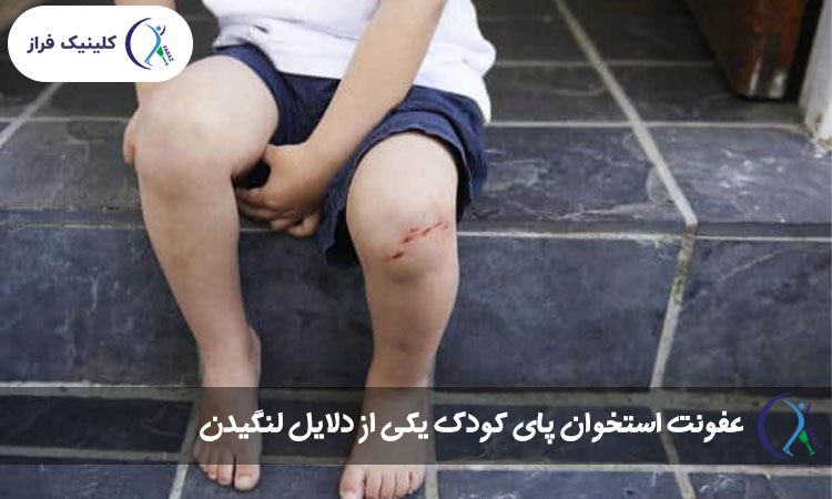 عفونت استخوان پای کودک یکی از دلایل لنگیدن