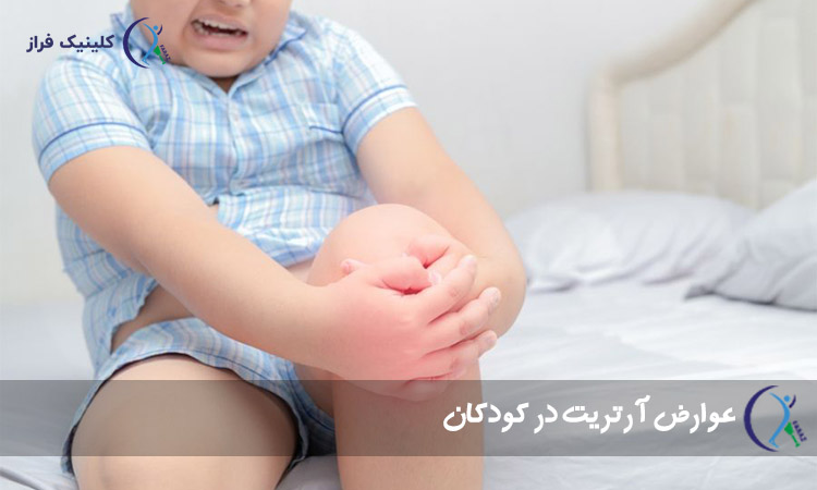 دلایل آرتریت در کودکان
