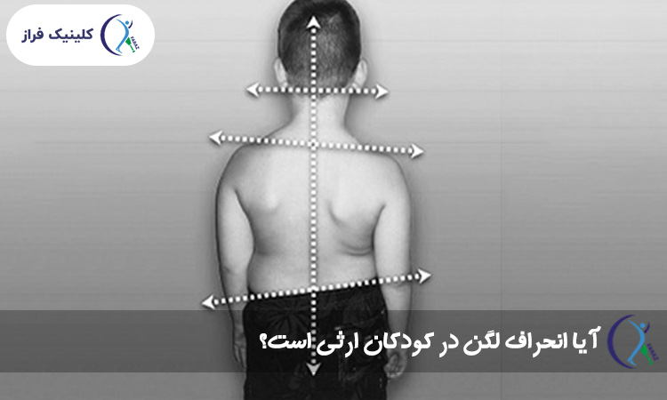 انحراف لگن در کودکان ارثی است؟